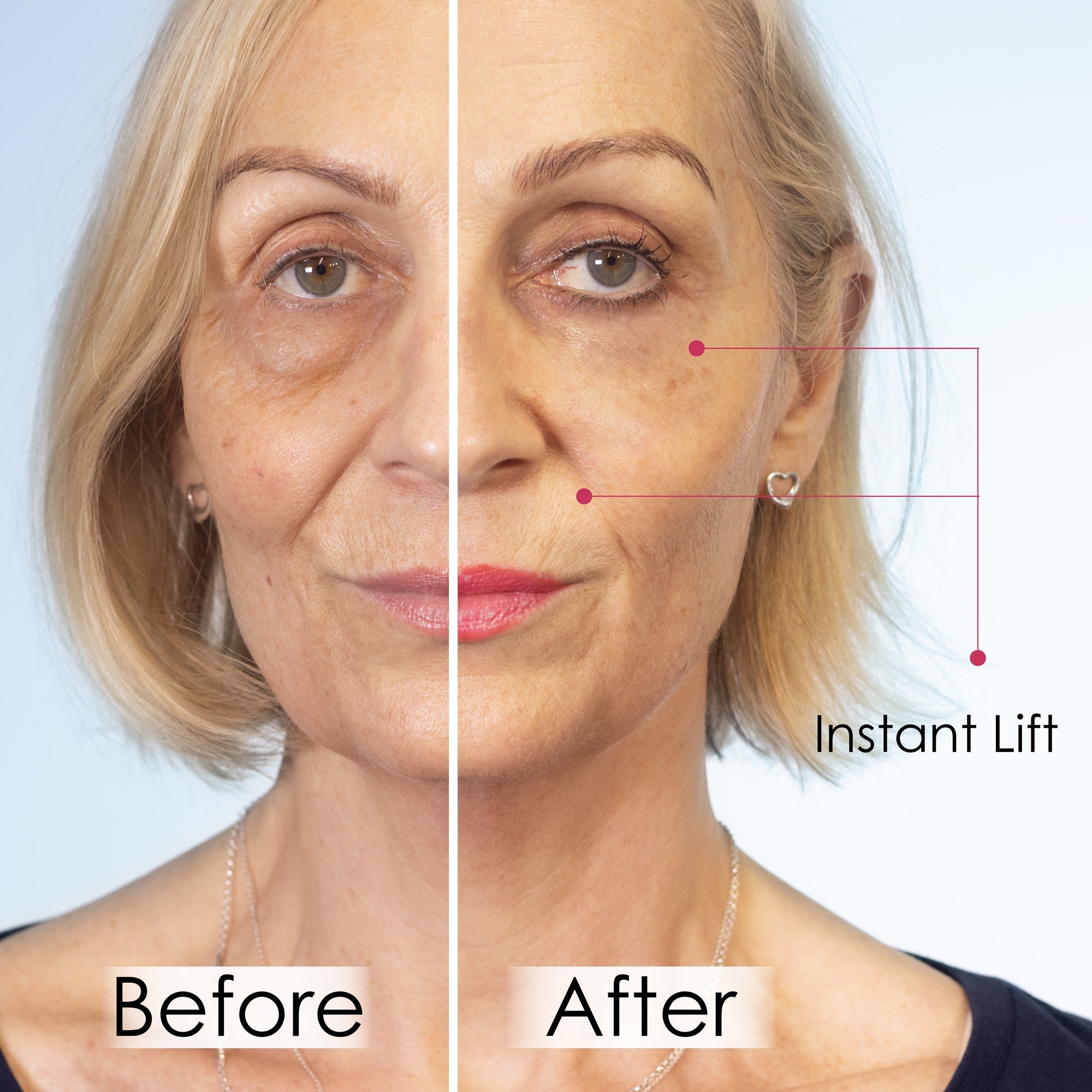 Wrinkle Killer Instant Lift with Hyaluronic Acid & Peptides